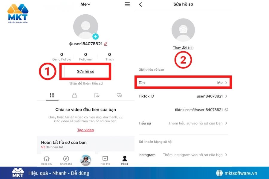 Cách đổi tên TikTok trên điện thoại (Android & iOS)